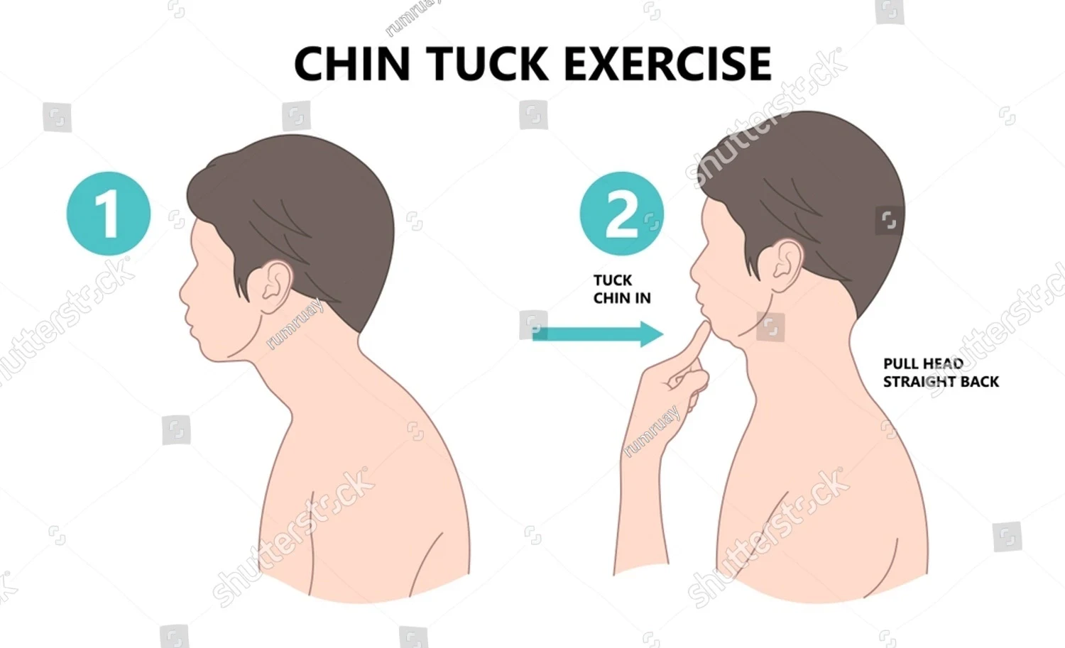 Chin Tucks