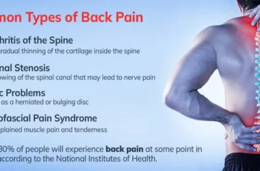 Chronic Back Pain