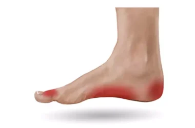 Foot Pain