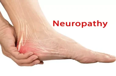 Neuropathy