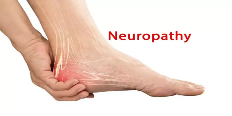 Neuropathy