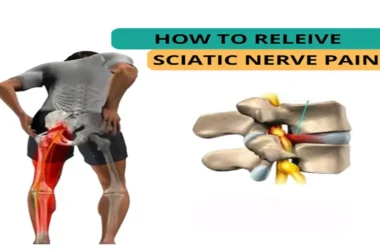 Sciatic Nerve Pain