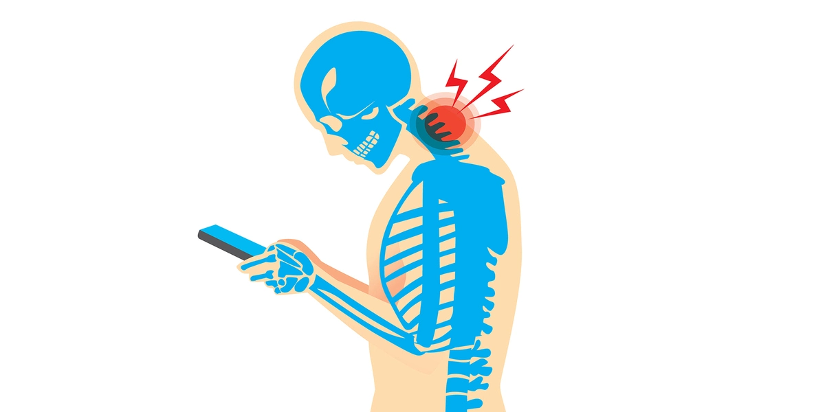 Smartphone Neck Pain